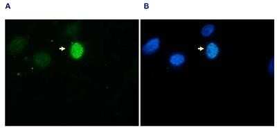 Immunofluorescence: Histone H3 [p Ser10] Antibody [NBP2-59167] - Hela asynchronous cells were stained with the antibody against H3S10p and with DAPI. Cells were fixed with formaldehyde, permeabilized with sodium citrate and Triton X100 and blocked with PBS containing 2.5% BSA. (A) Cells were immunofluorescently labelled with the H3S10p antibody (diluted 1:200 and incubated for 1 hour at room temperature) followed by goat anti-rabbit antibody conjugated to DyLight 488. (B) The nuclei were stained with DAPI, which specifically labels DNA. Phosphorylation of H3 on serine 10 occurs on condensed chromosomes during mitosis. This explains the dense staining of one of the cells (indicated with an arrow).